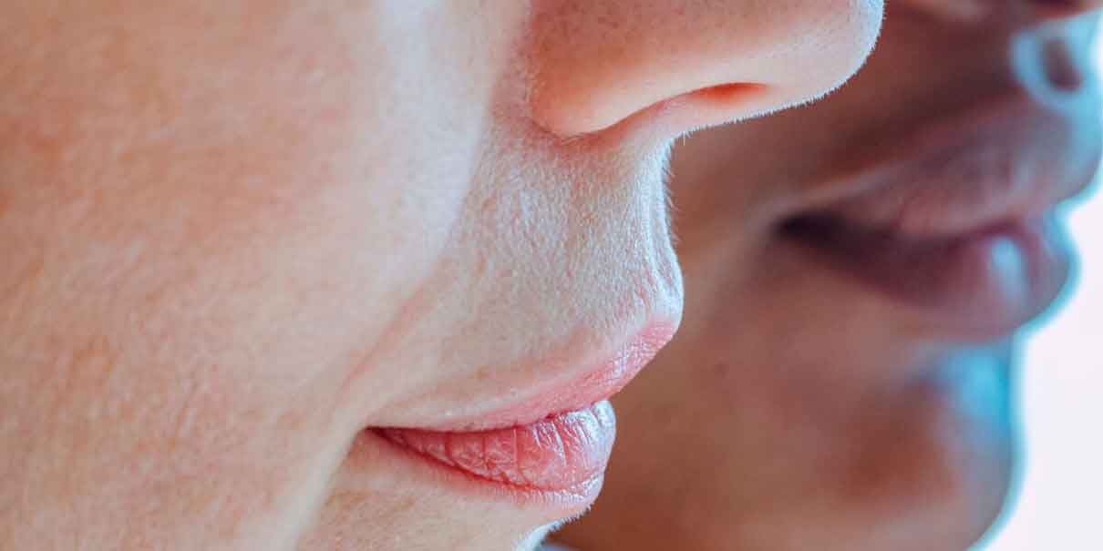 Cómo quitar las manchas del bigote sin empeorar el melasma