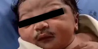 ¿Un bebé con bigote? La insólita apariencia del recién nacido se hace viral. VIDEO